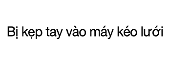 CASE 02  B  k p tay v o m y k o l  i