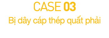 CASE 03  B  d y c p th p qu t ph i 
